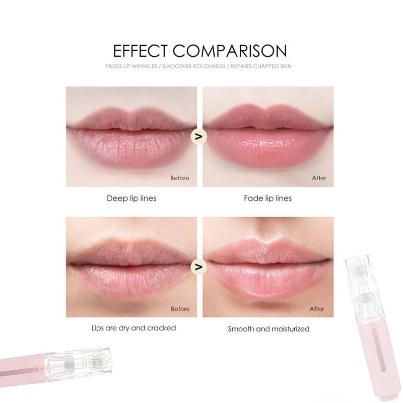 Lipp Roller & Lipp Booster Derma Roller mit Serum-Applikator